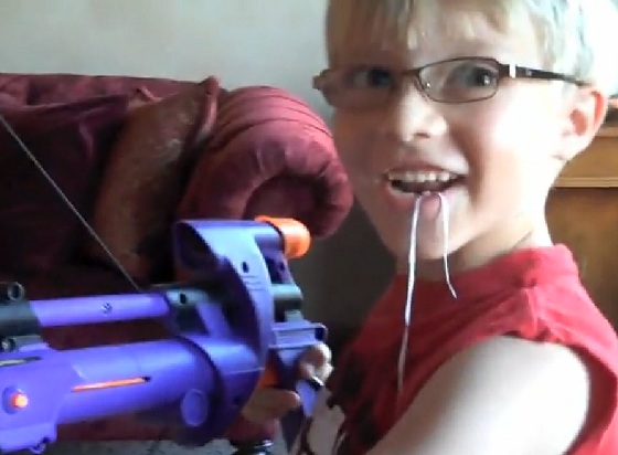 Pulling a tooth using a Nerf gun
